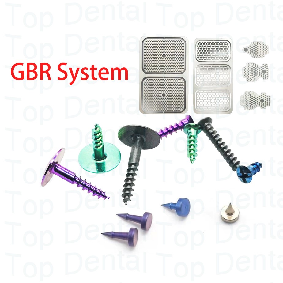 10pcs Dental GBR System Bone S - Stabilizer Screw In ulasan dan harga
